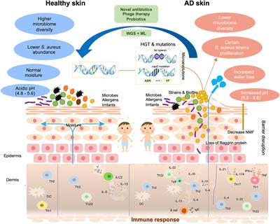 Understanding the role of Staphylococcus aureus in atopic dermatitis: strain diversity, microevolution, and prophage influences